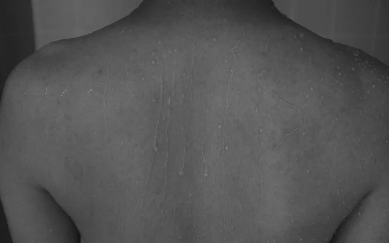 skin treatment for sensitive skin​